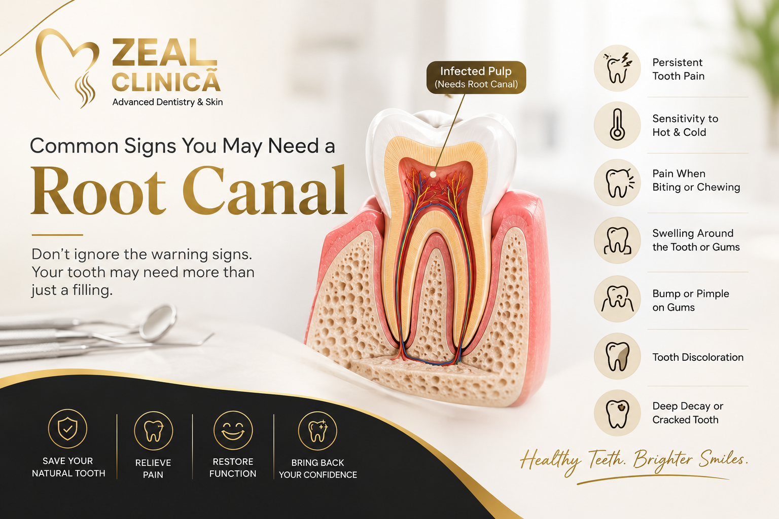 Common Signs You May Need a Root Canal | Zeal N Dentistry