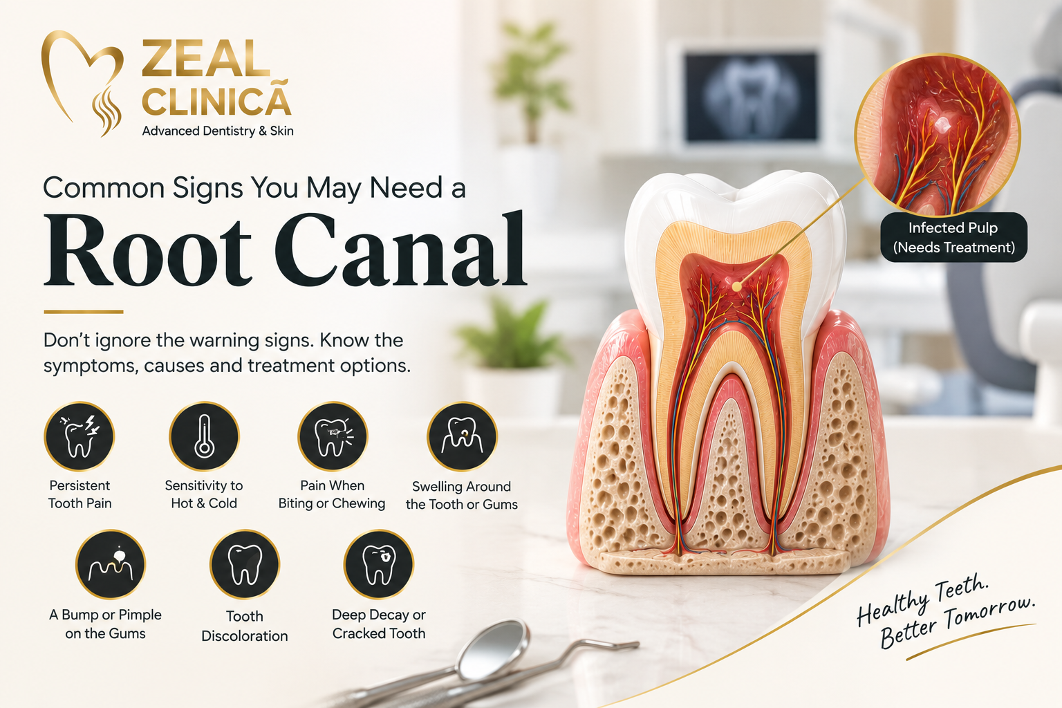 Common Signs You May Need a Root Canal | Zeal N Dentistry